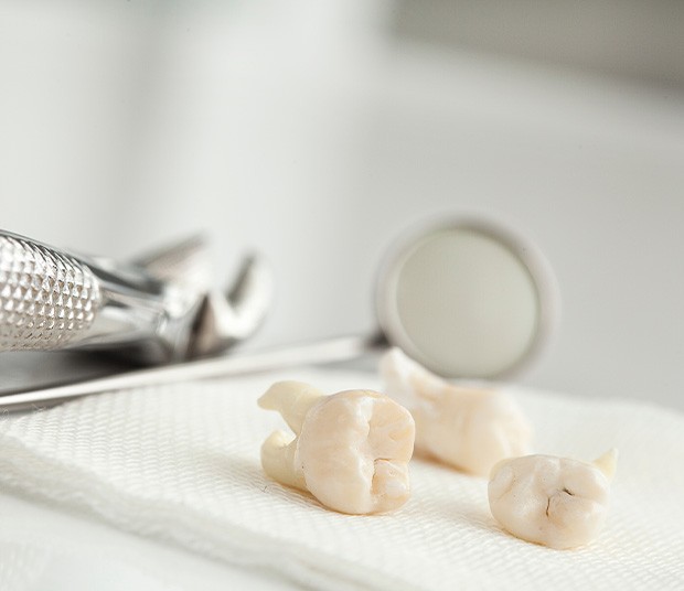 Several extracted teeth on a piece of gauze next to a mirror and forceps